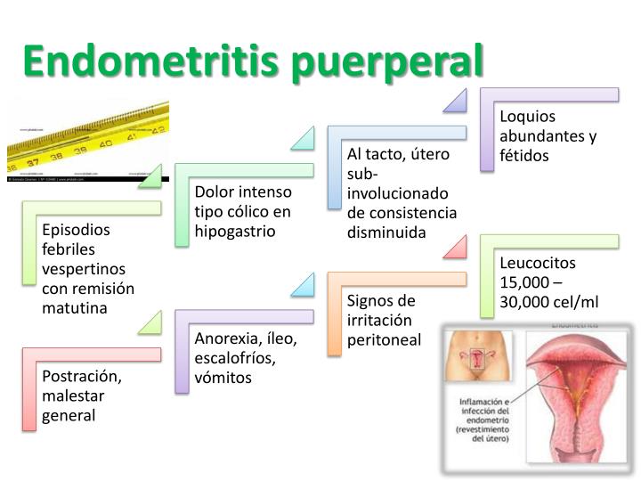 PPT Atención, Parto y Puerperio PowerPoint Presentation ID2027525