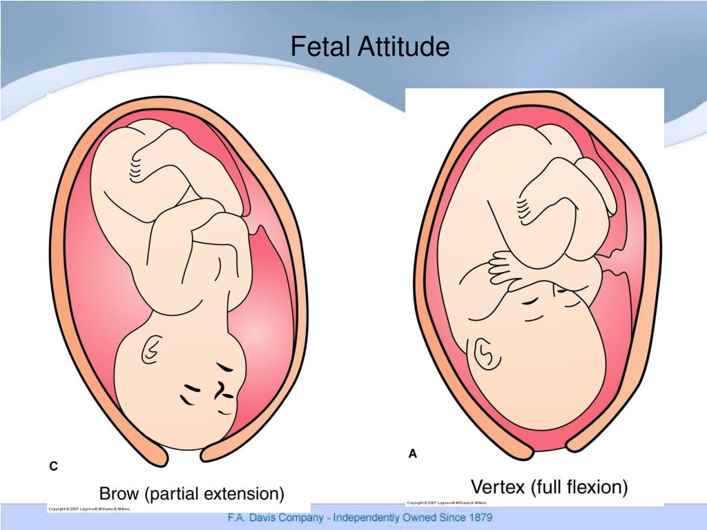 fetal presentation of the face