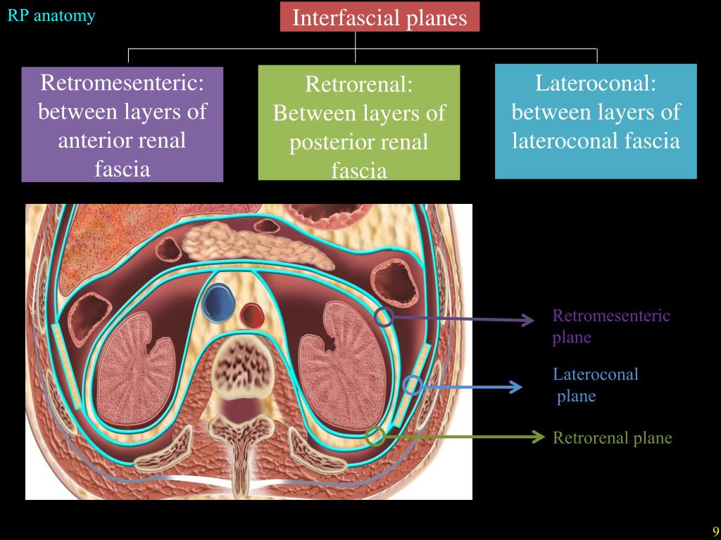 Ppt Overview Of Retroperitoneal Anatomy Masses And Disease Spread