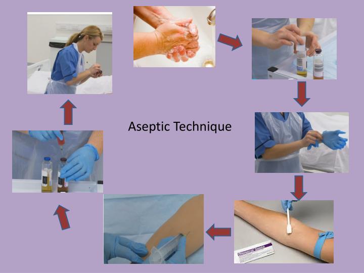aseptic procedure examples