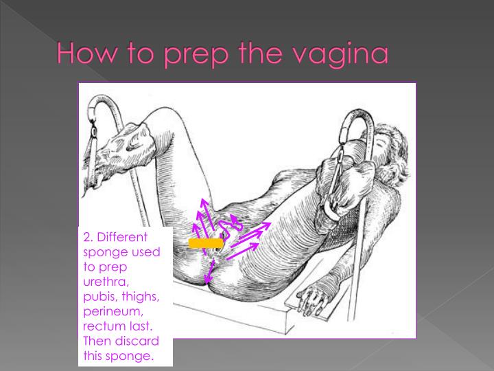 Have hit Vaginal surgical prep be. very Vaginal surgical prep