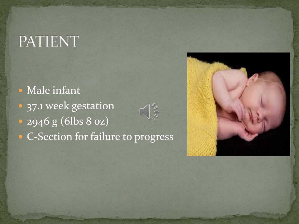 neonatal case presentation