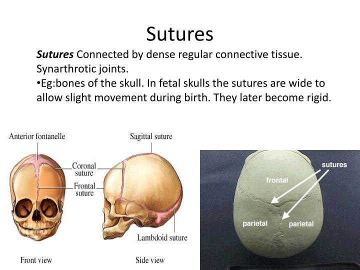 PPT Joints or Articulations PowerPoint Presentation ID2038133