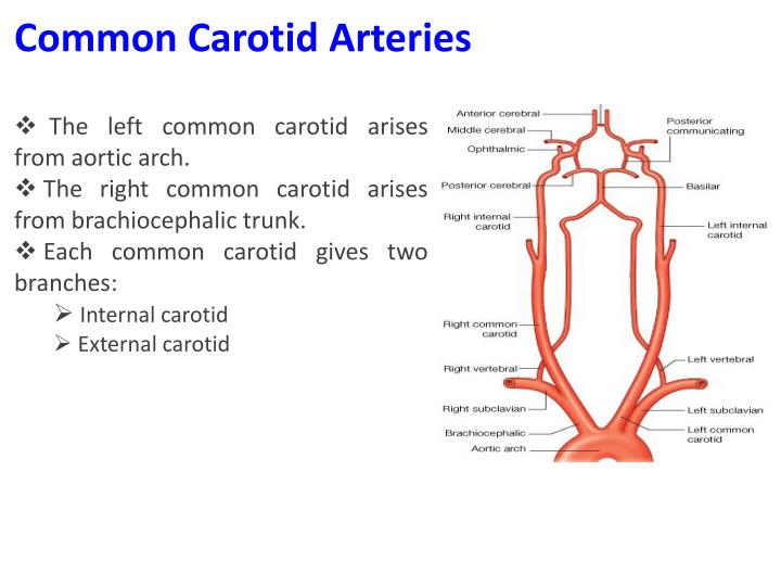 PPT - Major Body Arteries PowerPoint Presentation - ID:2038143
