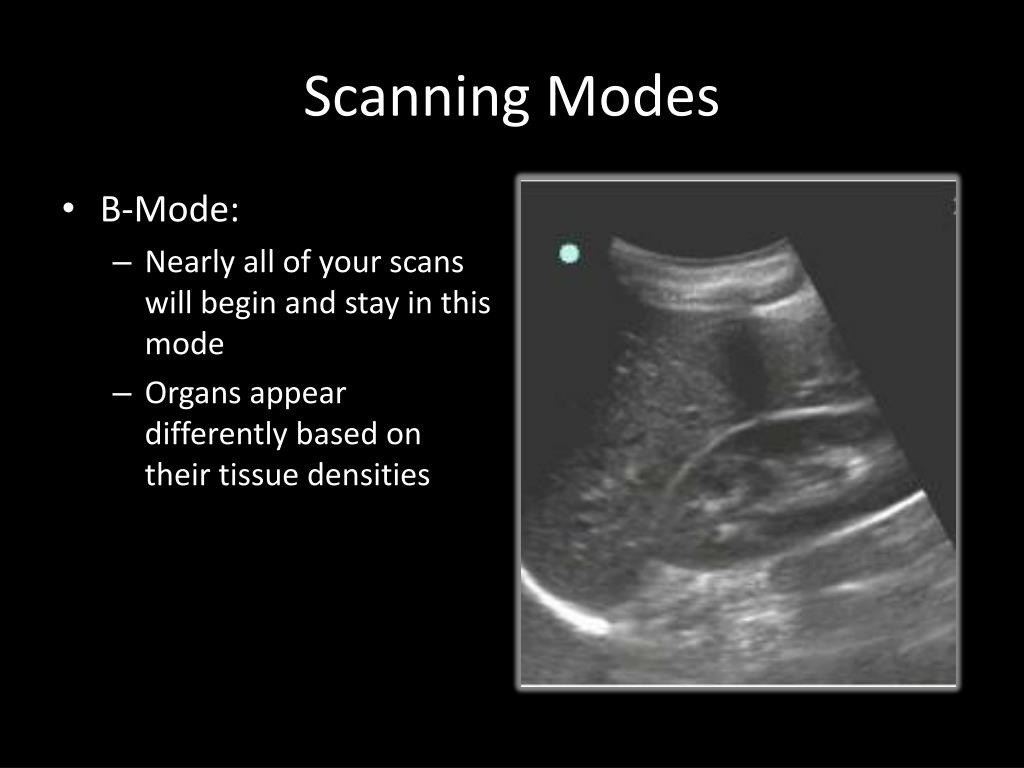 Ppt Basic Principles Of Ultrasound Powerpoint Presentation Free Download Id2043053 7250