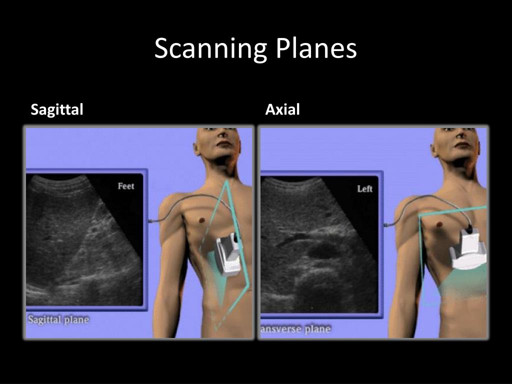 PPT Basic Principles Of Ultrasound PowerPoint Presentation Free 