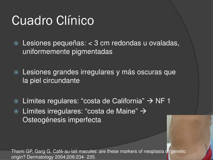 cuadro cl nico ppt manchas caf 233 con leche powerpoint presentation id cuadro cl nico ppt manchas caf 233 con leche powerpoint presentation id