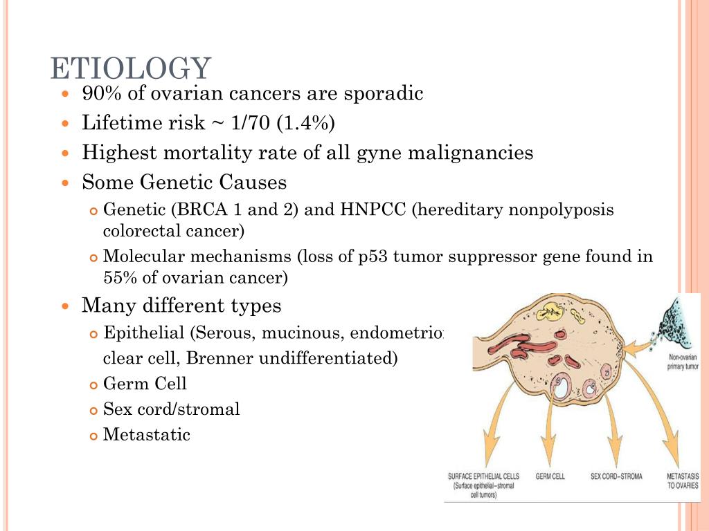 ovarian cancer etiology)