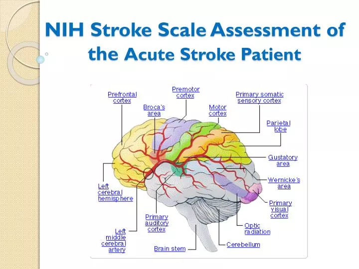 Ppt Nih Stroke Scale Assessment Of The Acute Stroke Patient | My XXX ...