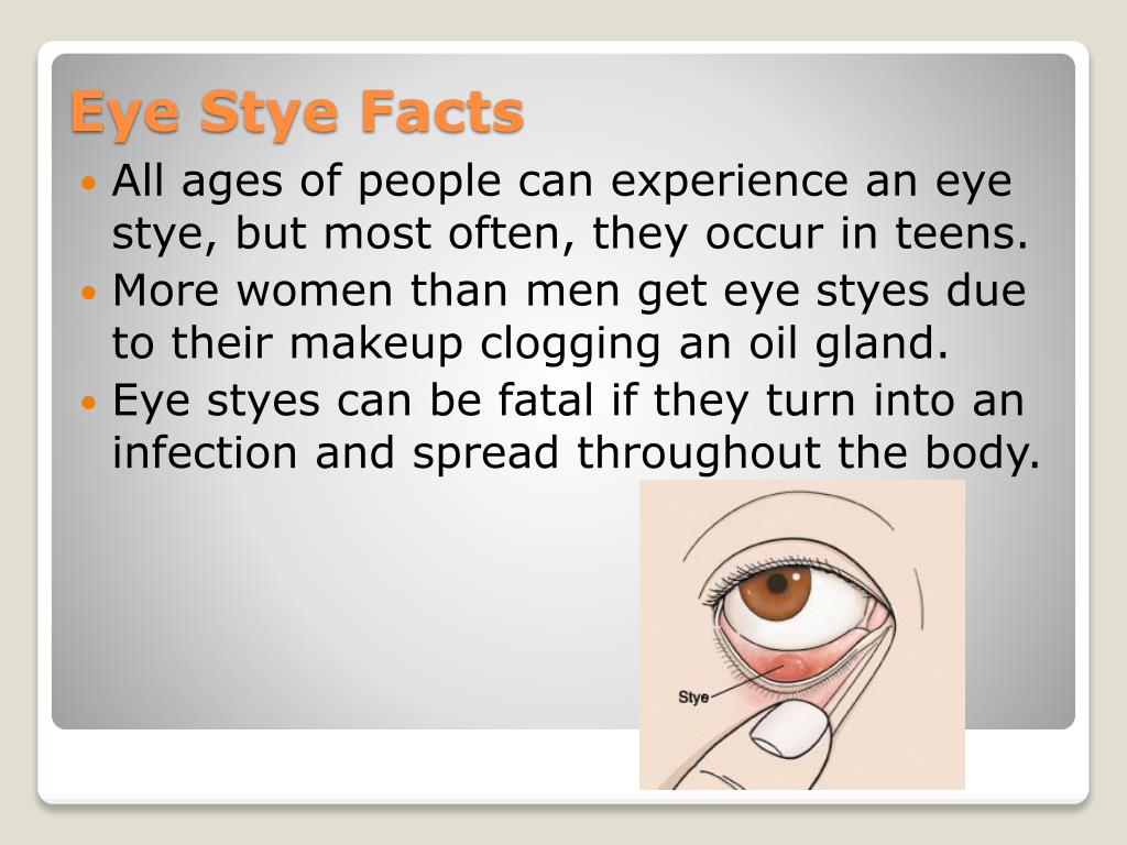 Ppt Eye Stye Powerpoint Presentation Free Download Id