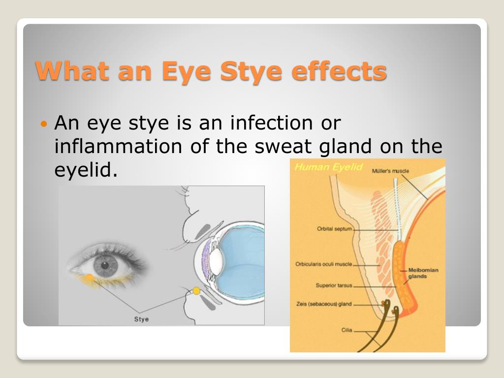Ppt Eye Stye Powerpoint Presentation Free Download Id2049097