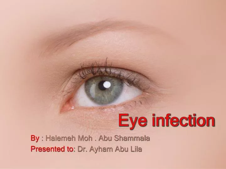 PPT Eye infection PowerPoint Presentation, free download ID2049121