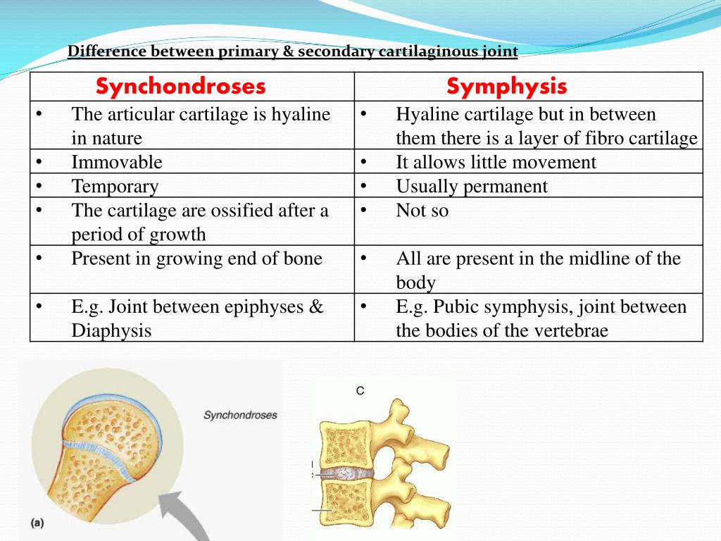 A synchondrosis equalizes pressure between vertebrae replacement pd catheter placement complications of diabetes