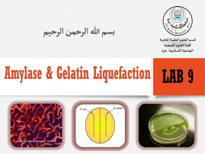 amylase lab amylase lab