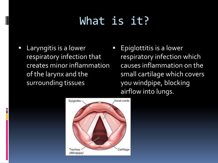 PPT Laryngitis & Epiglottitis PowerPoint Presentation ID2062887