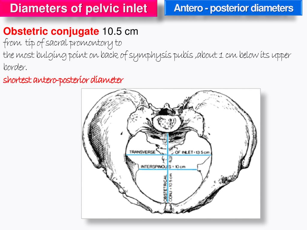 Ppt Pelvis Powerpoint Presentation Free Download Id2063192