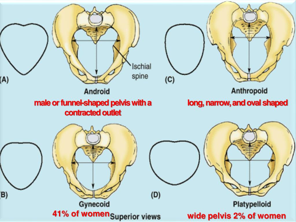 male or funnel-shaped pelvis with a contracted outlet.