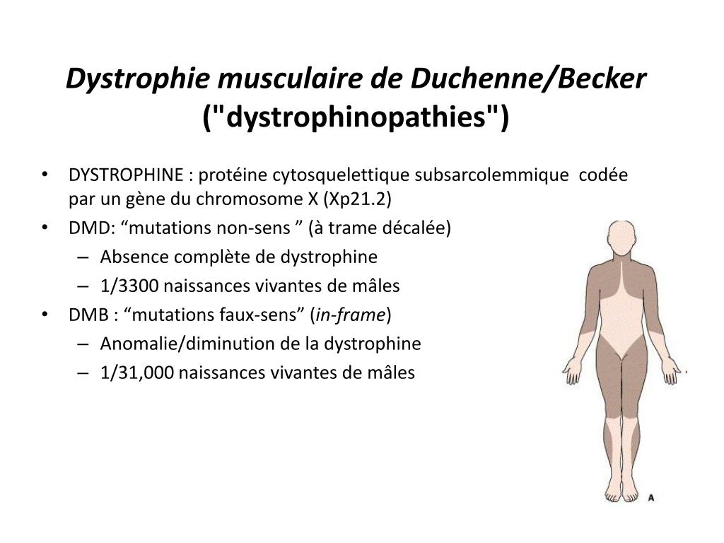 PPT - Maladies Musculaires Et Myasthenie Grave Pierre Bourque PowerPoint  Presentation - ID:2063522