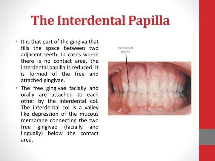 PPT PERIODONTIUM PowerPoint Presentation ID2067263