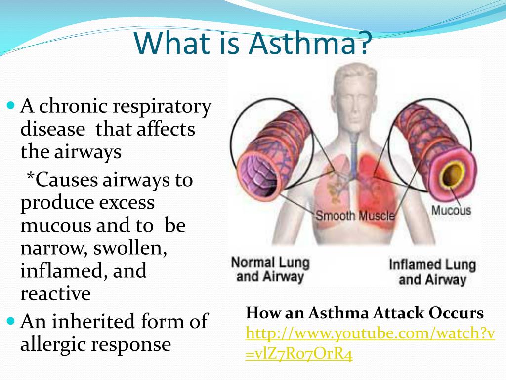 slide presentation on asthma