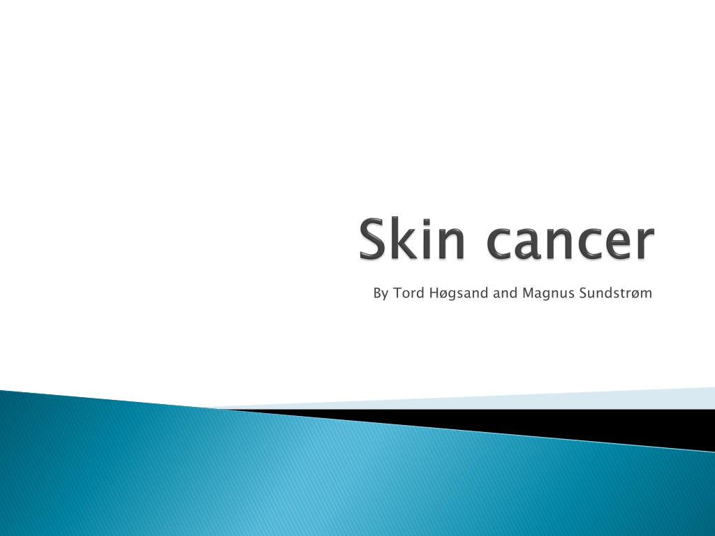 Ppt Skin Cancer Powerpoint Presentation Free Download Id2070610