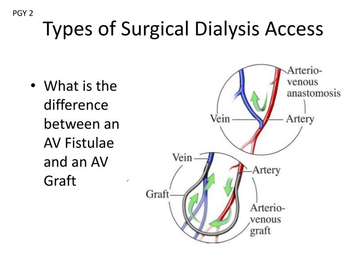 PPT Vascular and Intestinal Anastomotic