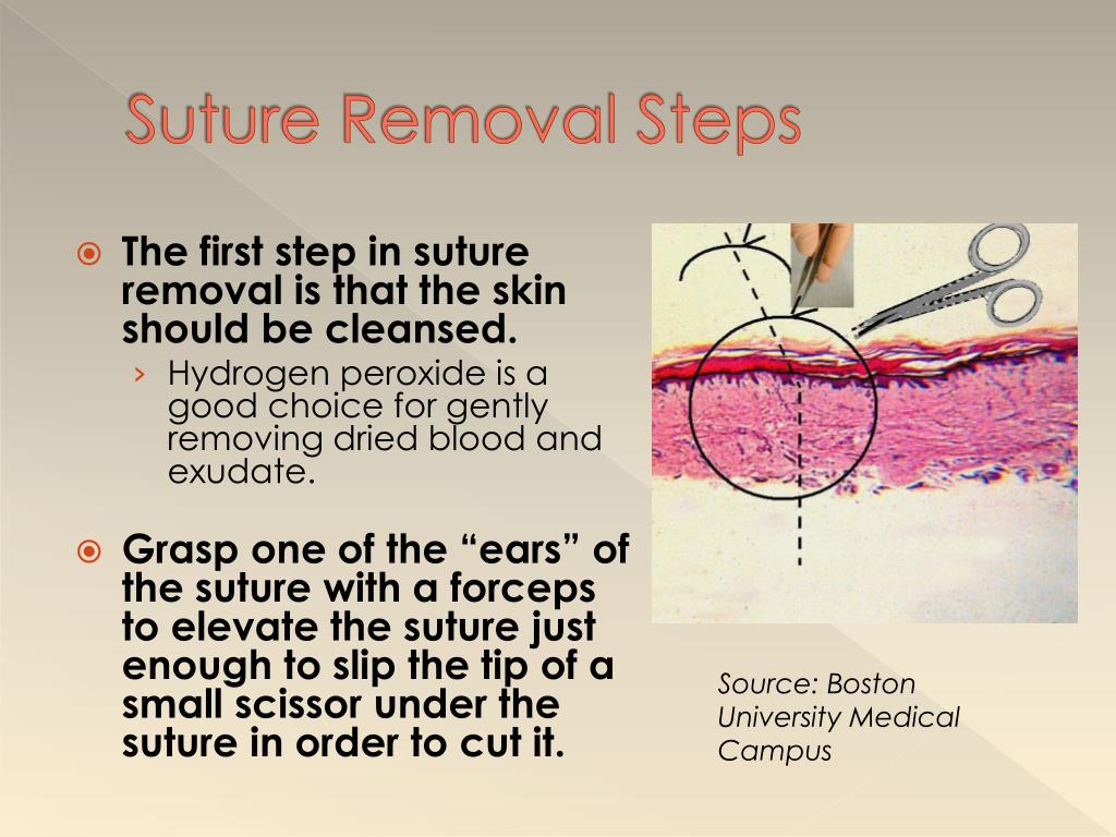 PPT Suturing PowerPoint Presentation, free download ID2079724
