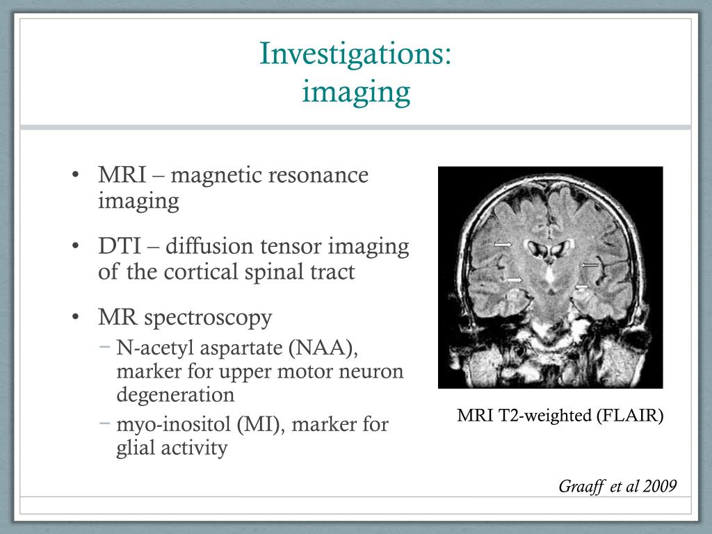 PPT Diagnosis of motor neuron disease PowerPoint Presentation, free