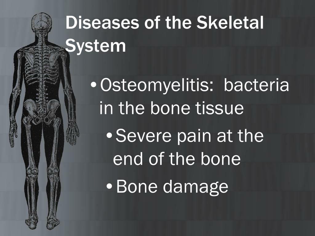 Ppt The Skeletal System Powerpoint Presentation Free Download Id