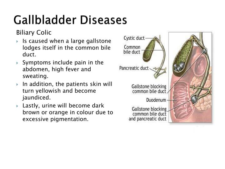 Gallbladder Diseases as related to Turmeric - Pictures