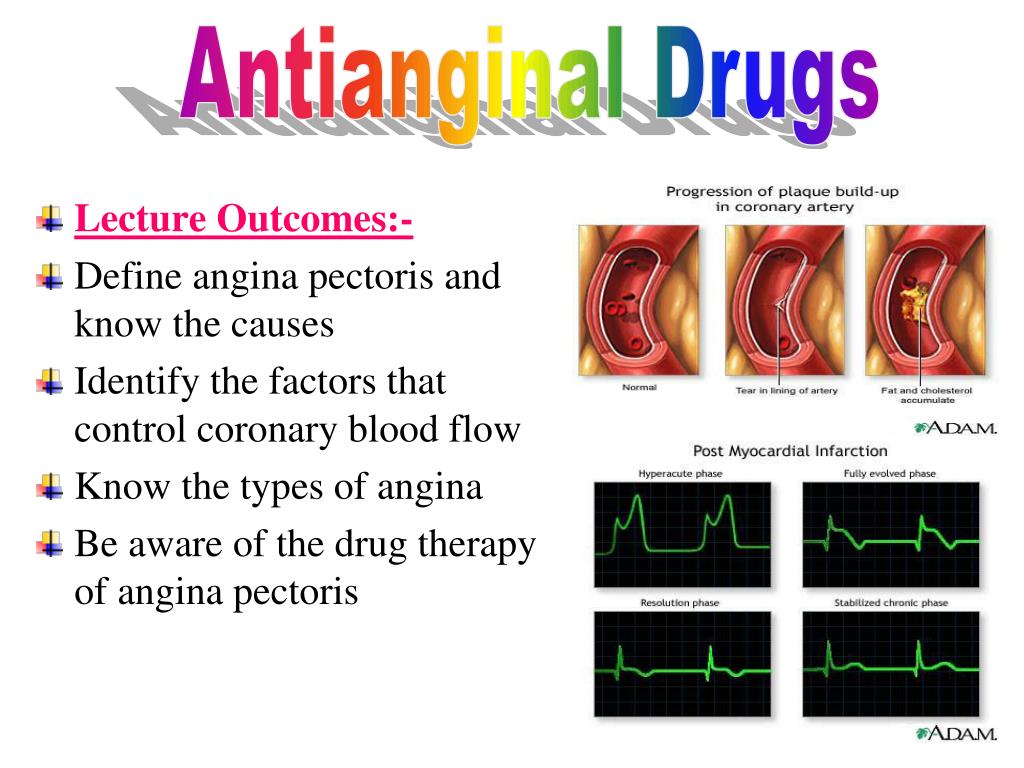 PPT - Lecture Outcomes:- Define angina pectoris and know the causes ...