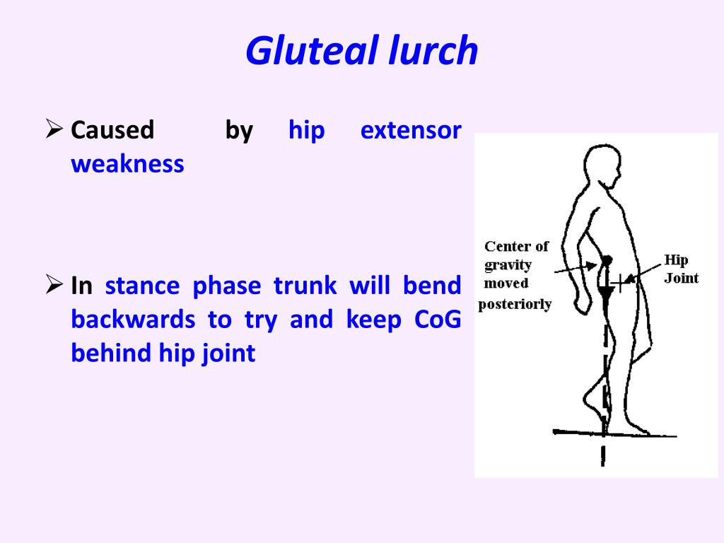 PPT Abnormal Gait PowerPoint Presentation Free Download ID 2088742 ppt-abnormal-gait-powerpoint-presentation-free-download-id-2088742