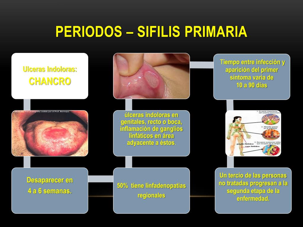 Sifilis primaria causas