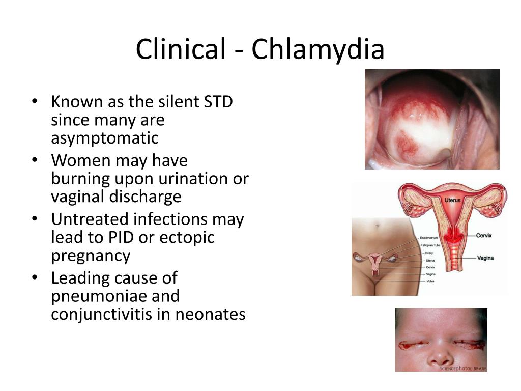 Chlamydia trachomatiscausessymptomstreatmenthow does it spreadprevention