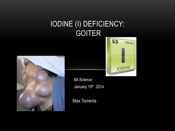 PPT iodine (I) deficiency Goiter PowerPoint Presentation, free