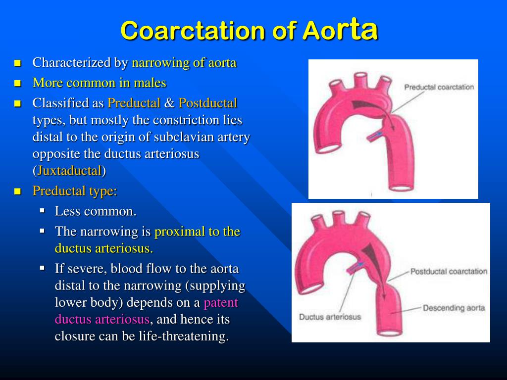 PPT - The Aortic Arches PowerPoint Presentation, free download - ID:2090347