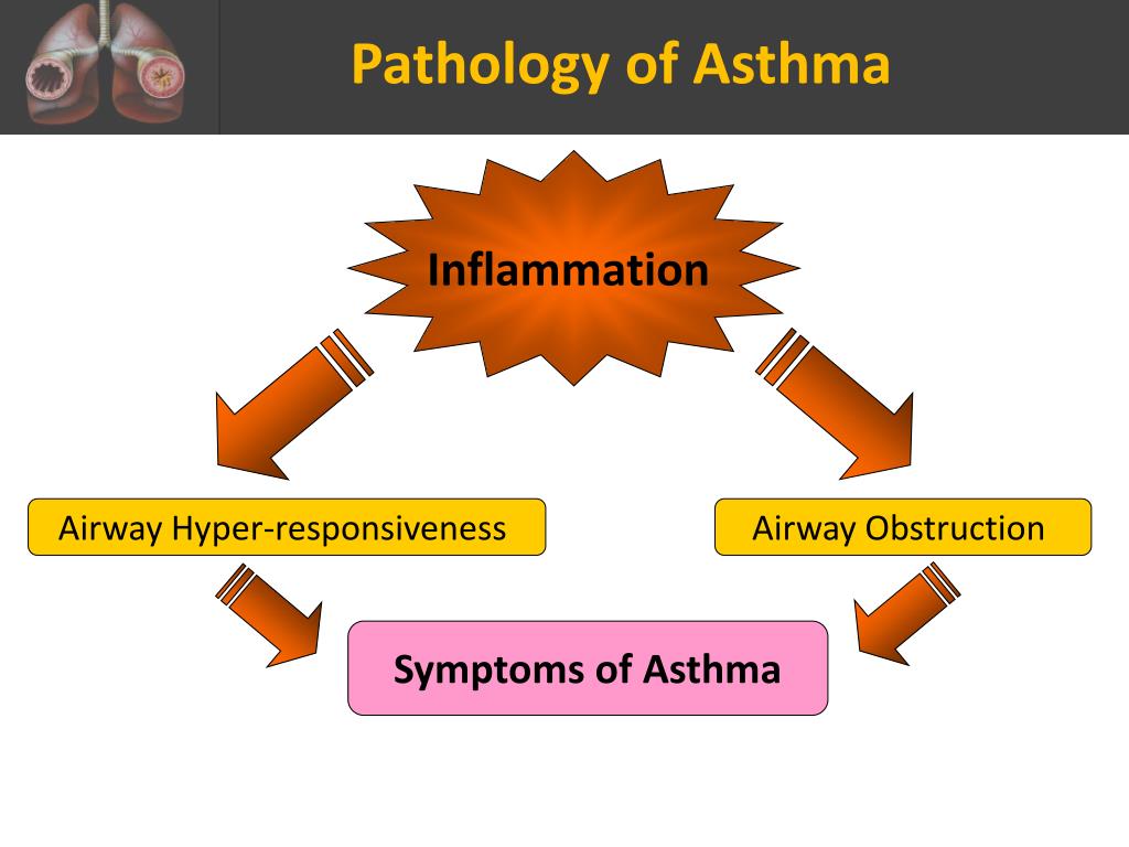 bronchial asthma case study ppt