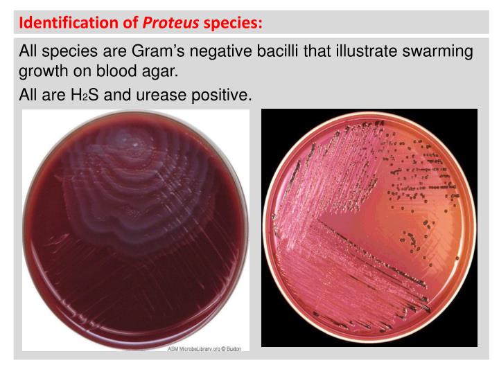 prodeus infection prodeus infection