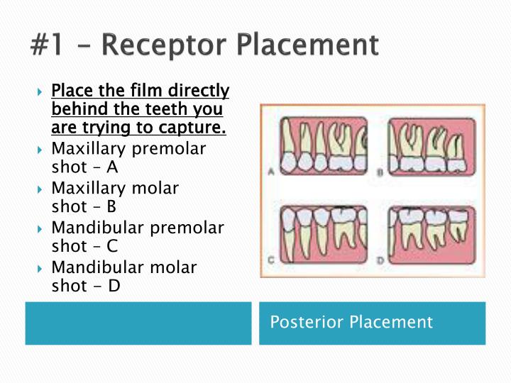 PPT Paralleling Technique Part 2 Film Sizes and Rules PowerPoint