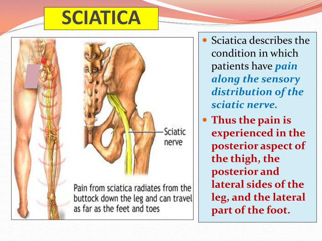 ppt-sciatic-nerve-powerpoint-presentation-free-download-id-2103698