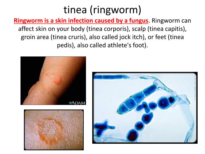 PPT - Integumentary System and Accessory Organs PowerPoint Presentation ...