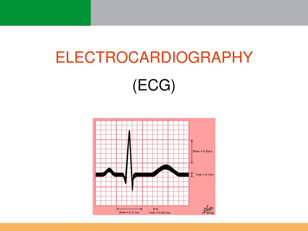 ecg powerpoint presentation download