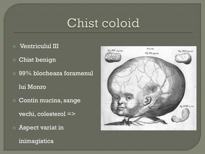 PPT - Putina anatomie … Fara nu se poate … PowerPoint Presentation - ID ...