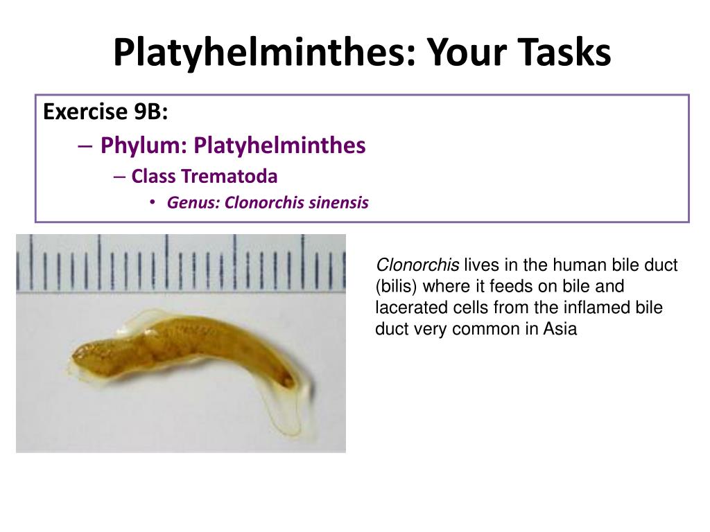 Filo platyhelminthes - A Metazoa filogénia feltételezett útvonalai