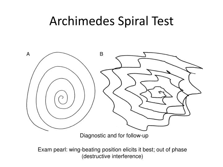 Ppt Approach To Tremors Powerpoint Presentation Id 2115774