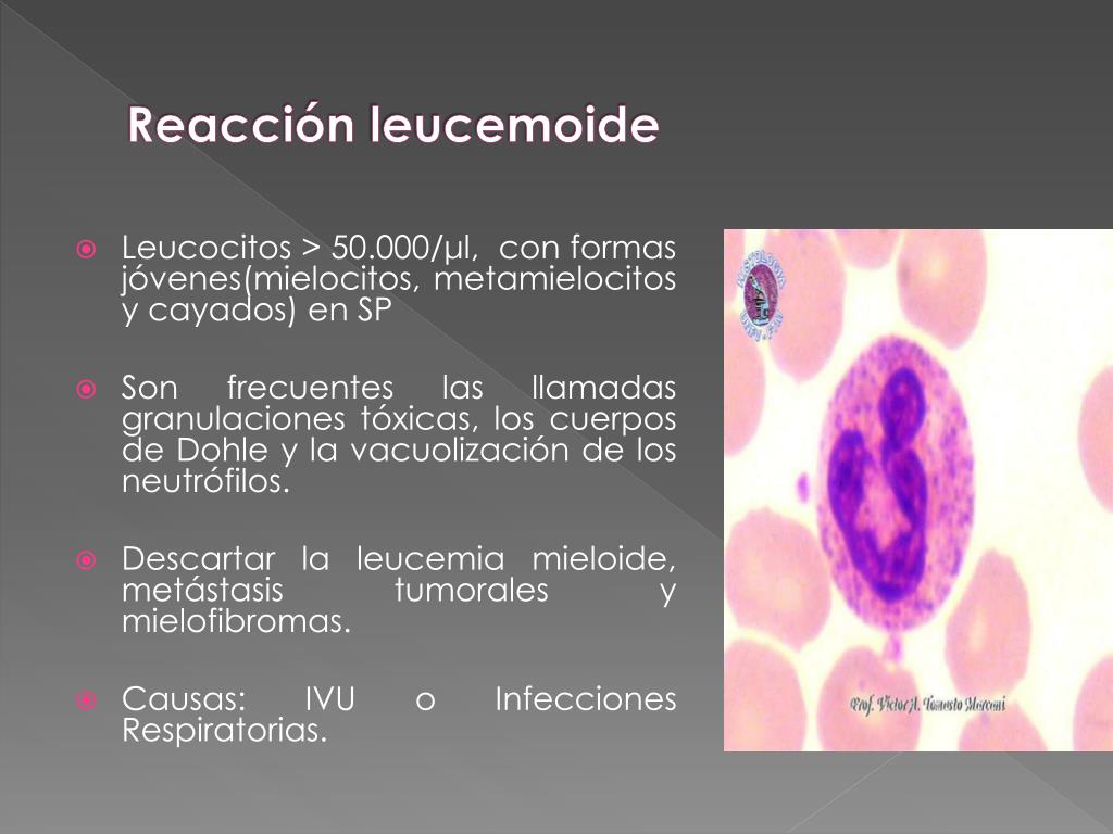 PPT - INTERPRETACION DEL HEMOGRAMA EN PEDIATRIA PowerPoint Presentation