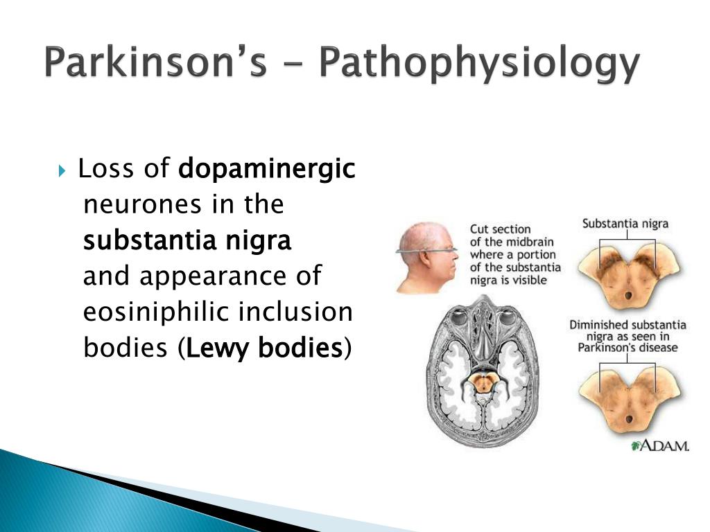 definition of pathological disease definition of pathological disease