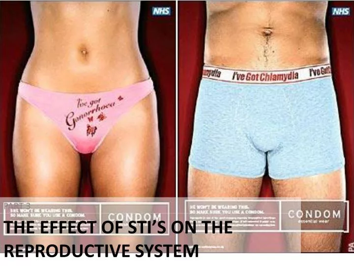 the effect of sti s on the reproductive system n.
