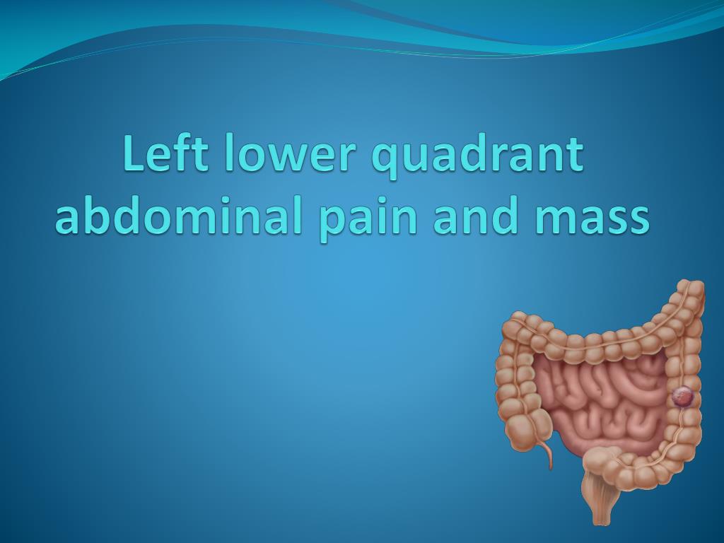 PPT - Left Lower Quadrant Abdominal Pain And Mass PowerPoint Presentation - ID:2134717