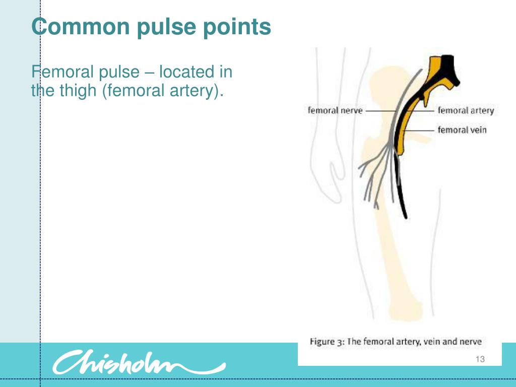 How To Find Femoral Pulse Newborn Examination NIPE WGSY How To Find Femoral Pulse Newborn Examination NIPE WGSY